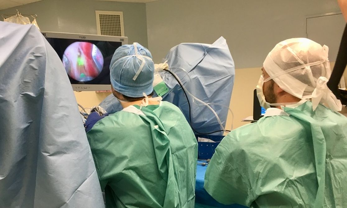 ENUCLEATION DE LA PROSTATE le laser HOLEP une avancée technique au